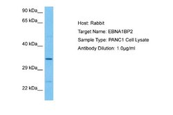 EBNA1BP2 Rabbit anti-Human, Polyclonal, Novus Biologicals 0.1ml; Unconjugated:Antibodies,